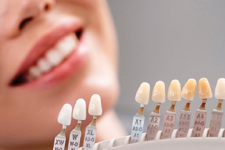 How To Choose The Correct Cosmetic Dentist In Bali
